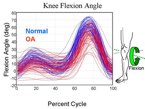 Knee Flexion OA and normal